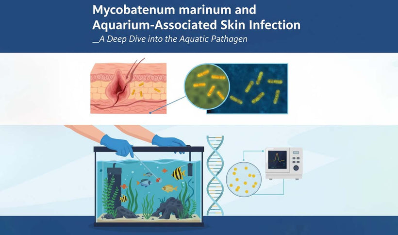Mycobacterium marinum: Aquarium-Associated Skin Infection