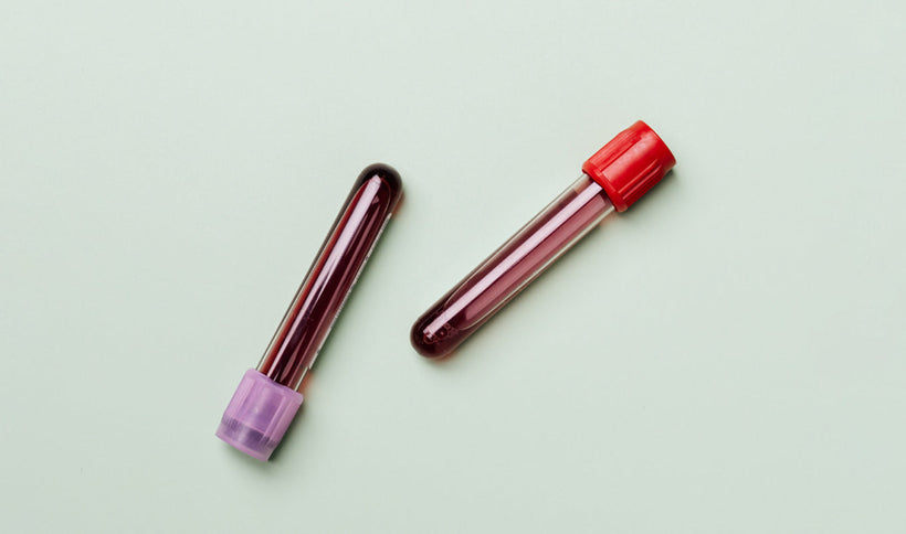 How Does a Centrifuge Separate Blood?