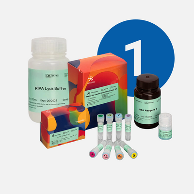 Protein Extraction &amp; Preparation