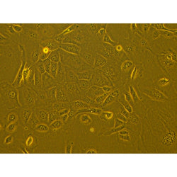 Human Primary Gingival Epithelial Cells