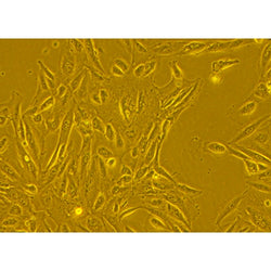 Human Primary Bronchial Epithelial Cells