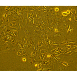 Human Primary Colonic Epithelial Cells
