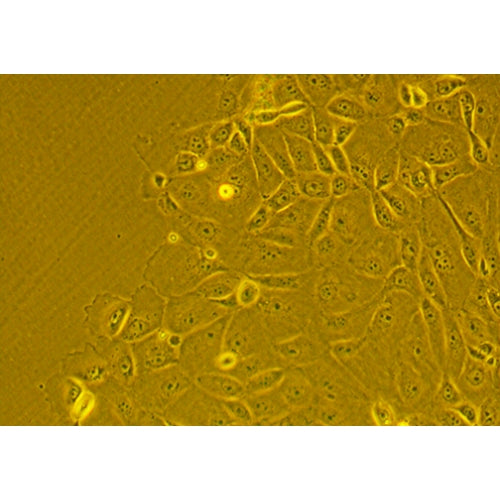 Human Primary Alveolar Epithelial Cells