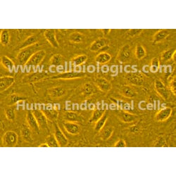 Human Primary Retinal Microvascular Endothelial Cells
