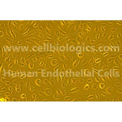 Human Primary Small Intestinal Microvascular Endothelial Cells