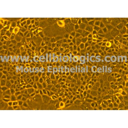 Diabetic Mouse Colonic Epithelial Cells