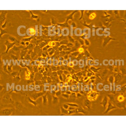 Diabetic Mouse Esophageal Epithelial Cells