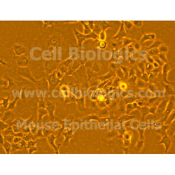 Diabetic Mouse Liver Epithelial Cells