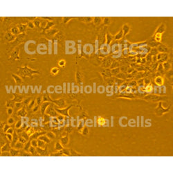 Diabetic Mouse Dermal Epithelial Cells