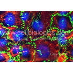 Diabetic Mouse Cardiac Microvascular Endothelial Cells