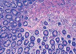 Eosin Staining Solution-Biosci™ - Biofargo - 