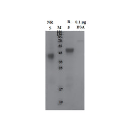 SDS-PAGE analysis of Recombinant Mouse LRP2 Protein Tag Free showing protein purity by Coomassie Blue staining