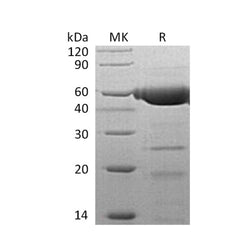 SDS-PAGE analysis of recombinant human PLRP2 protein showing high purity pancreatic lipase-related protein 2