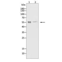Anti-HEXB antibody - OmnimAbs - Biofargo - 