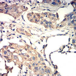 Anti-HEXB antibody - OmnimAbs - Biofargo - 