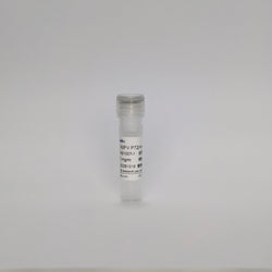 Recombinant ASFV P72