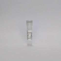 Recombinant Human Prolactin