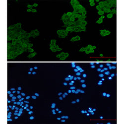 ACTR1B rabbit monoclonal antibody