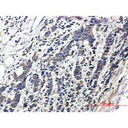 ACTR1B rabbit monoclonal antibody
