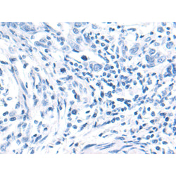 BCAR1 rabbit polyclonal antibody