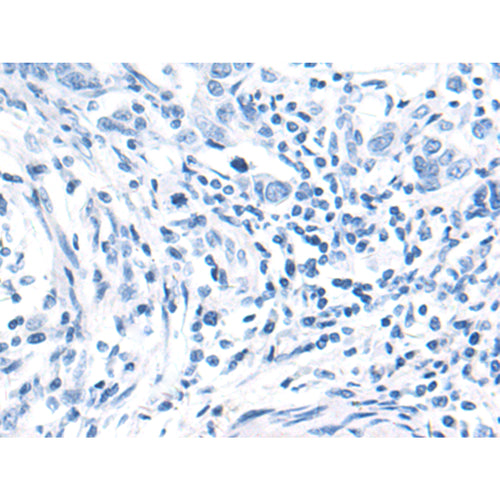 BCAR1 rabbit polyclonal antibody