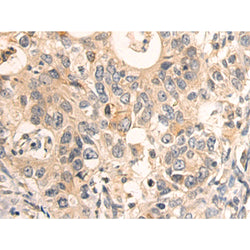 BCAR1 rabbit polyclonal antibody