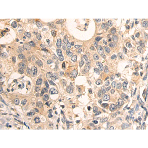BCAR1 rabbit polyclonal antibody