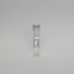 Recombinant S100-β Protein (S100β-mAb)