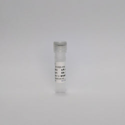 Recombinant S100-β Protein (S100β-mAb)