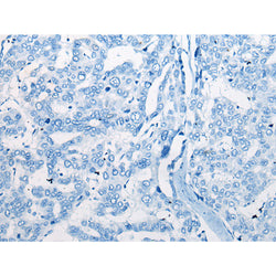 CEND1 rabbit polyclonal antibody