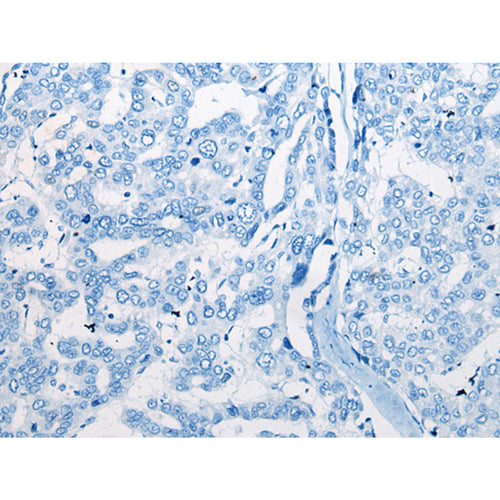 CEND1 rabbit polyclonal antibody