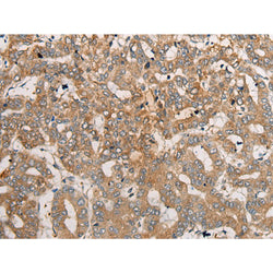 CEND1 rabbit polyclonal antibody