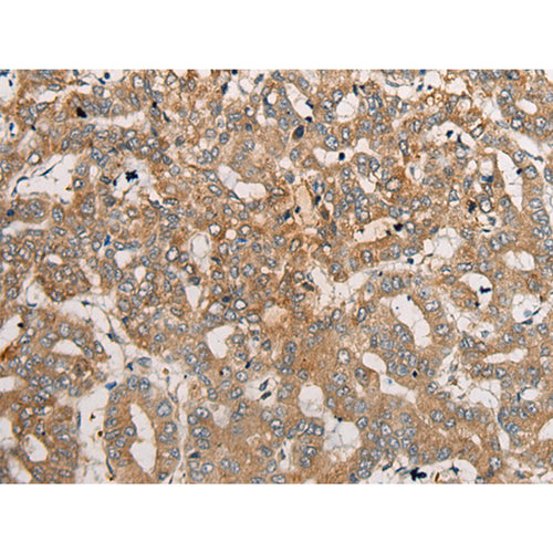 CEND1 rabbit polyclonal antibody