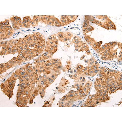 EMC7 rabbit polyclonal antibody