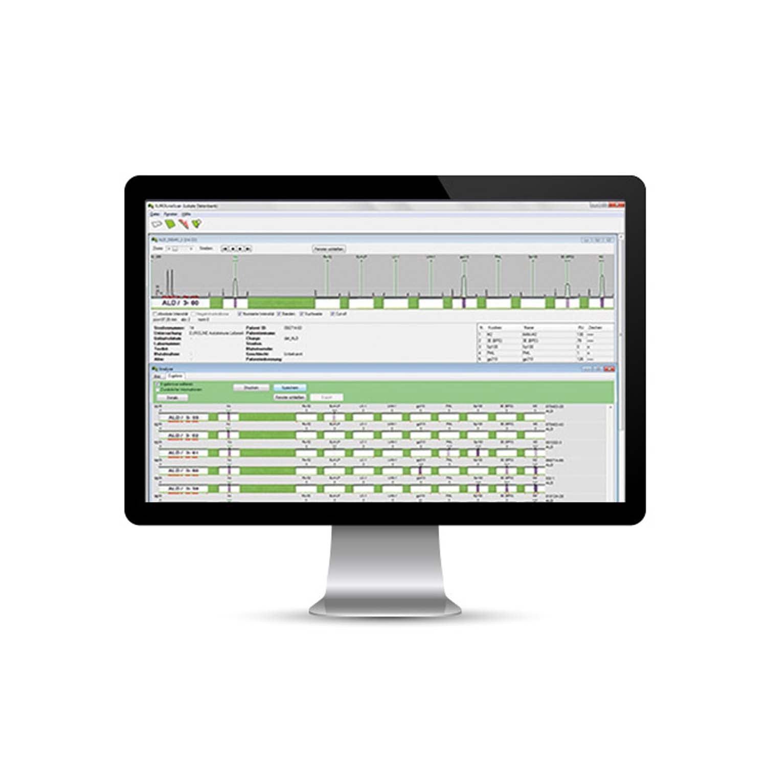 EUROLineScan Automated Evaluation of Membrane-Based Test Systems