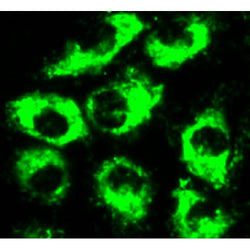 Cynomolgus Monkey Primary Lung Microvascular Endothelial Cells