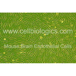 Diabetic Mouse Brain Microvascular Endothelial Cells