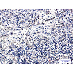 FDPS rabbit monoclonal antibody