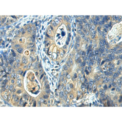 FUT1 rabbit polyclonal antibody