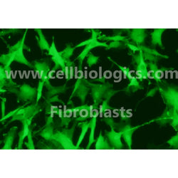 Human Primary Bronchial Fibroblasts
