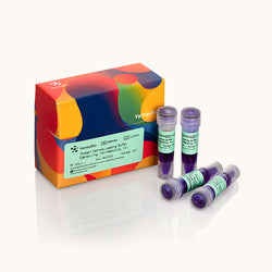 Protein Sample Loading Buffer-Denaturing-non-Reducing-5x-Yamaybio