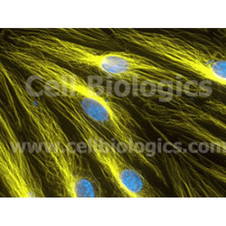 Human Primary Thyroid Microvascular Endothelial Cells