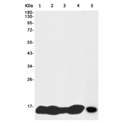 Histone H2A.X (phospho-Ser139) rabbit monoclonal antibody