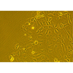 Human Primary Alveolar Epithelial Cells