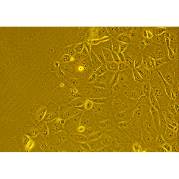 Human Primary Alveolar Epithelial Cells