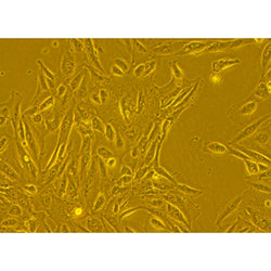 Human Primary Bronchial Epithelial Cells