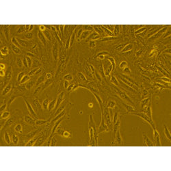 Human Primary Kidney Epithelial Cells