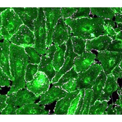 Human Primary Oral Mucosal Epithelial Cells