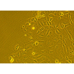 Human Primary Ovarian Epithelial Cells