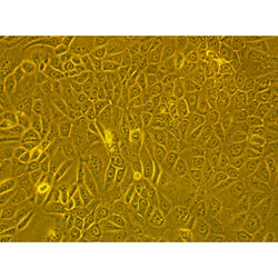 Human Primary Pancreatic Epithelial Cells